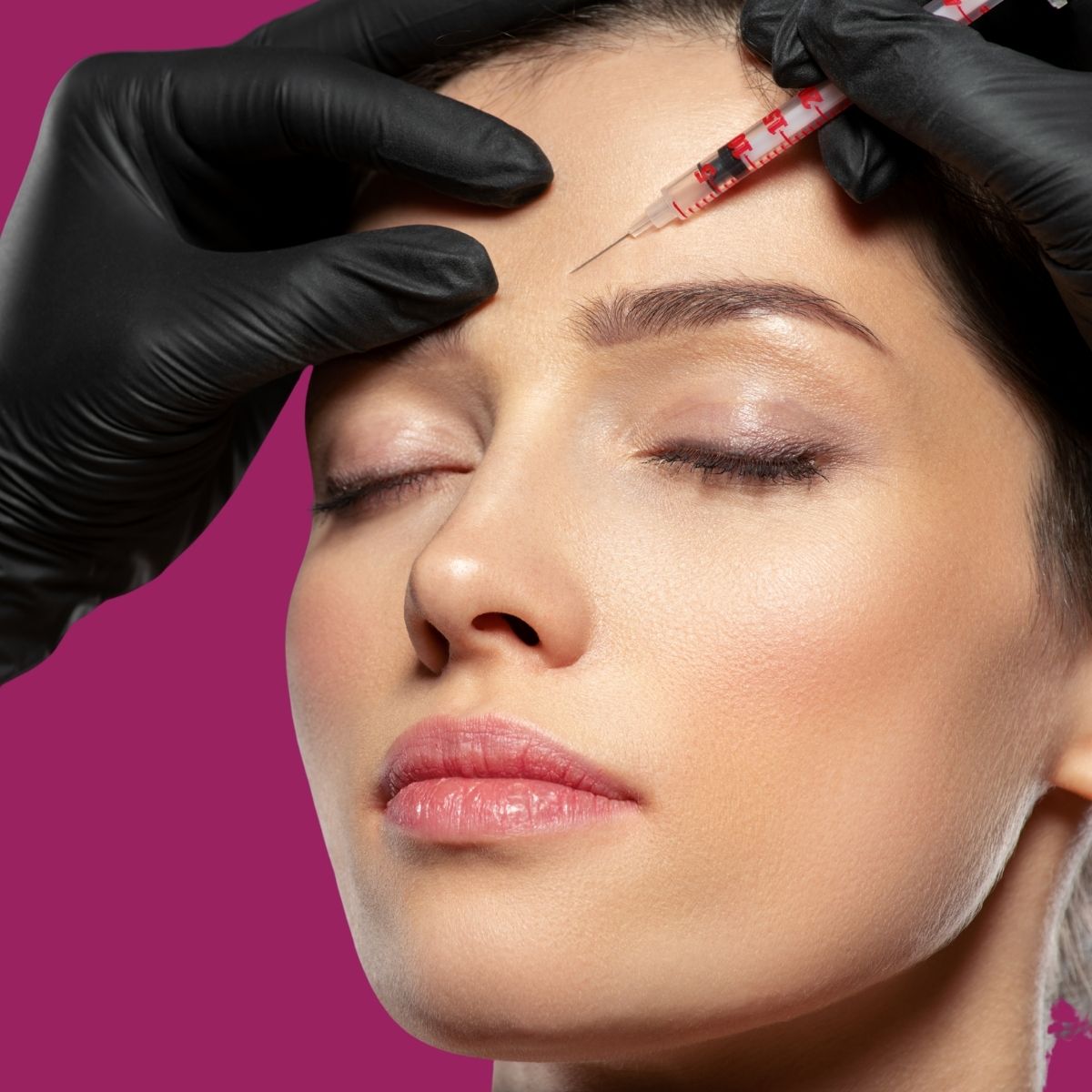 Injections de Botox®